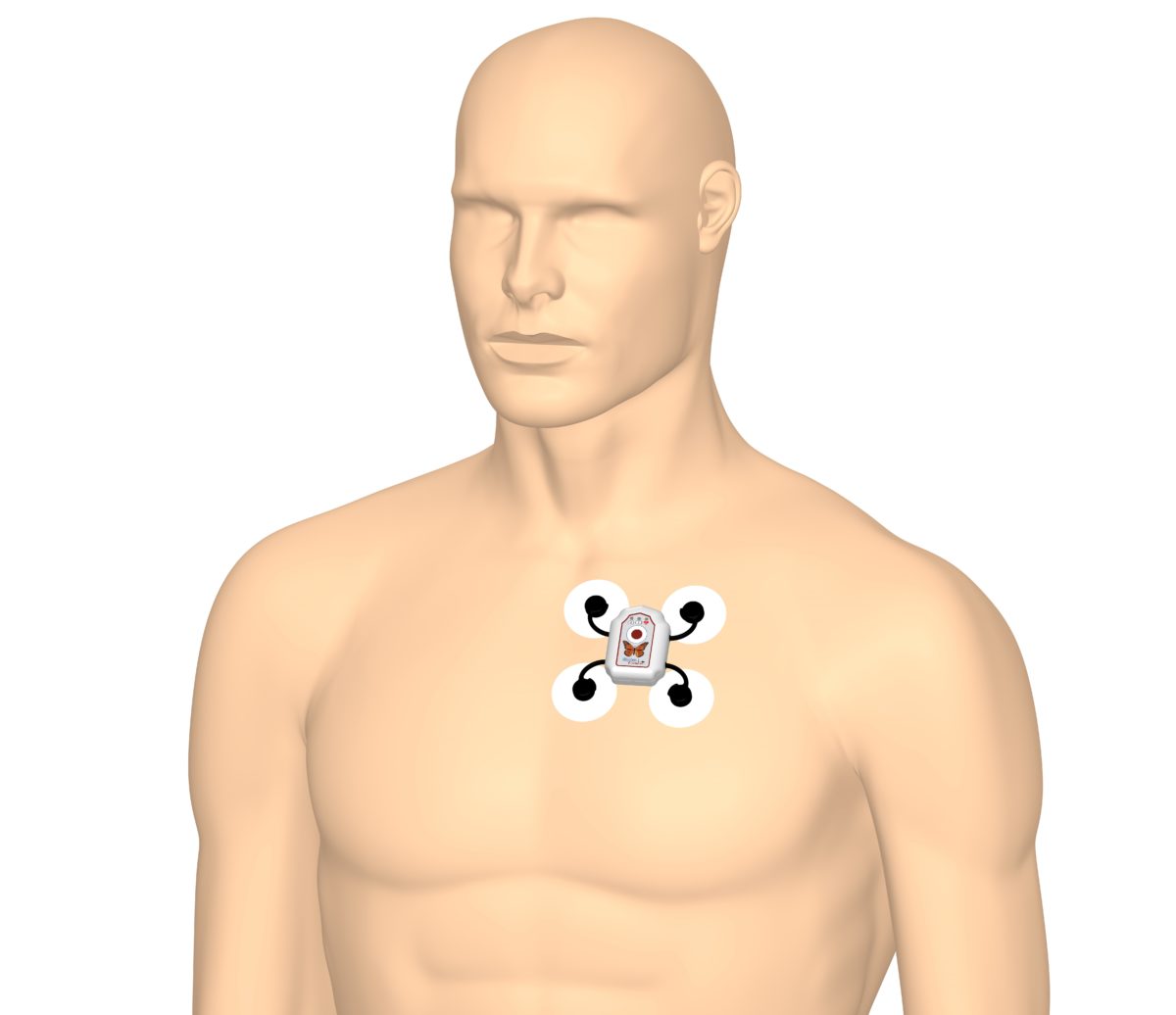 For Patients Rhythm Express ECG