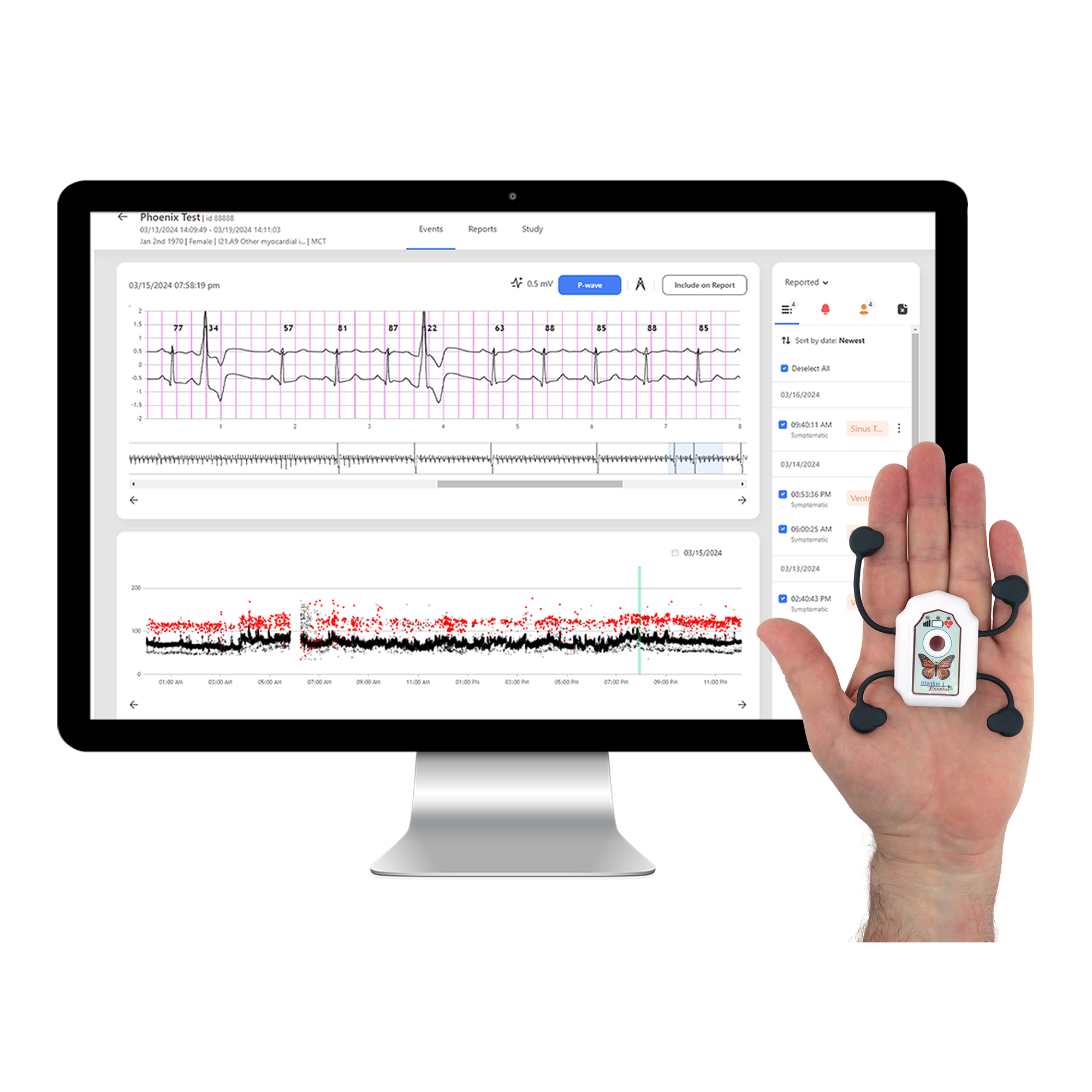 Monitor with Rhythm Express cardiac monitoring report on screen, with a hand besides it holding the RX-1 mini.