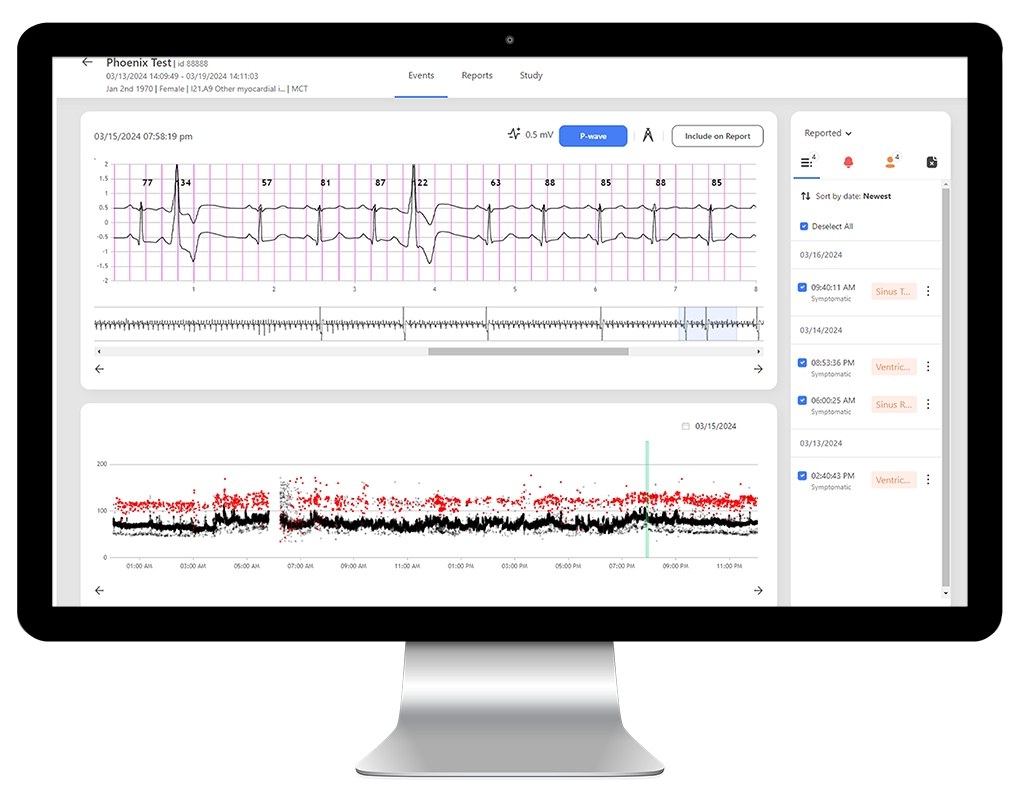 Desktop monitor with report showcasing Remote Cardiac Monitoring Solution by Rhythm Express.