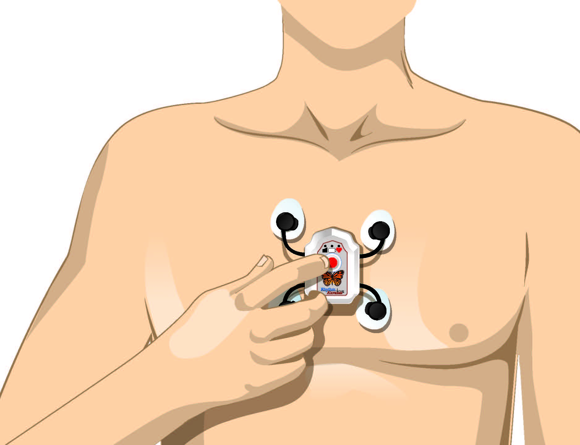 Illustration of step three, recording symptoms for the RX-1 mini.