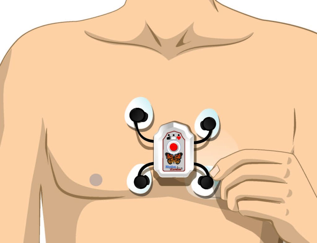 Illustration of electrodes on the RX-1 mini.